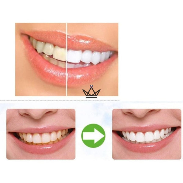 Poudre de blanchiment dentaire 100% naturelle - 30 g - Atelier Atypique